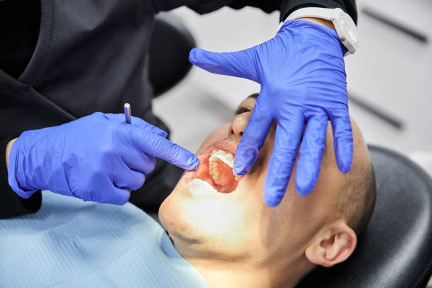 Best Emergency Dental Extractions in Brock Hall, MD